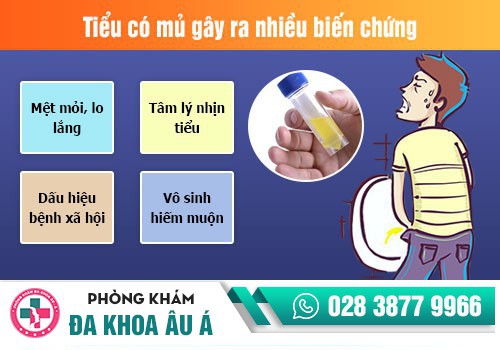 Đi đái ra mủ do lậu cầu có nguy hiểm không?