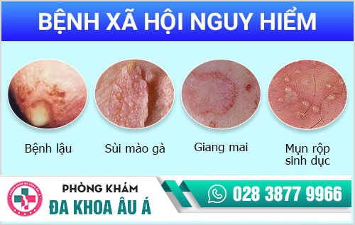 Các bệnh ngoại khoa nam Thường Gặp
