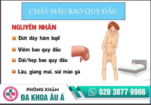NGUYÊN NHÂN CHẢY MÁU BAO QUY ĐẦU