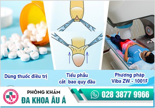 Điều trị đau tinh hoàn bằng phương pháp nào hiệu quả?
