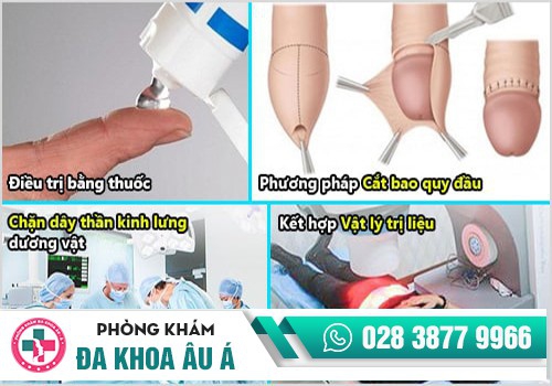 Phương pháp điều trị liệt dương tâm lý