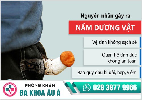 Nấm dương vật là một trong những bệnh lý bao quy đầu thường gặp