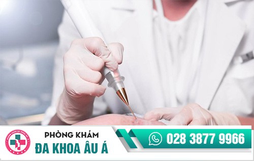 điều trị sùi mào gà ở đâu, trị sùi mào gà ở đâu uy tín, nên điều trị sùi mào gà ở đâu