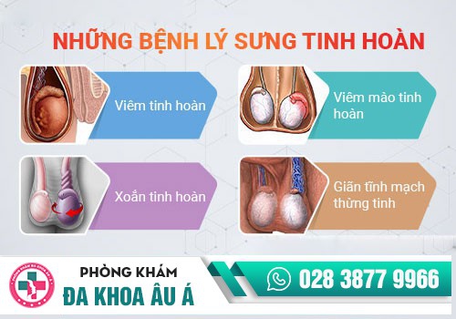 Tinh hoàn bên phải bị sưng là do đâu?