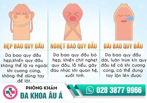 Dài bao quy đầu