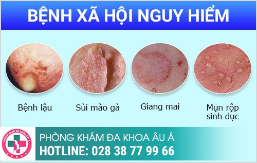 Bệnh ngoại khoa nam thường gặp