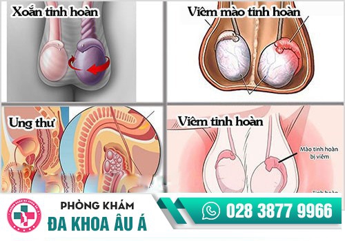 NGUYÊN NHÂN NHỨC TINH HOÀN, NHỨC MÀO TINH HOÀN