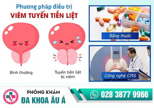 Bệnh nhân chiếu sóng viba chữa đau tuyến tiền liệt 