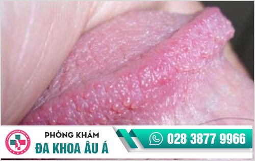 Hình ảnh hạt ngọc dương vật