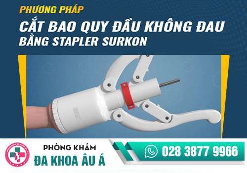 Phương pháp cắt bao quy đầu hiện đại