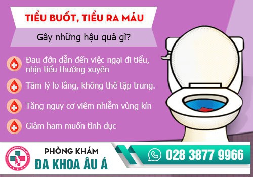 TIỂU RÁT SAU QUAN HỆ CÓ SAO KHÔNG?