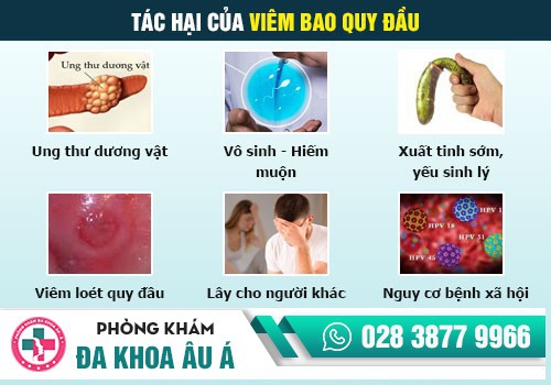 Tác hại của viêm bao quy đầu