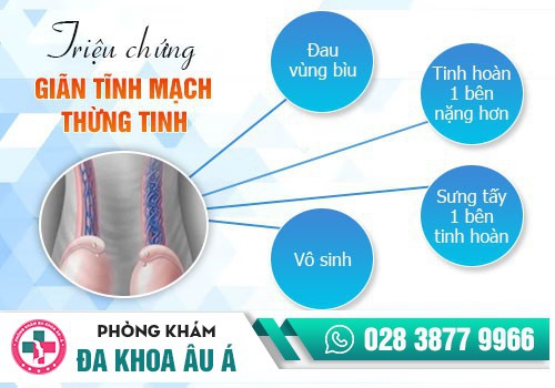 Giãn tĩnh mạch thừng tinh