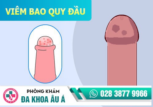 Sưng dương vật do nhiều nguyên nhân gây nên