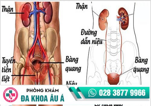 VIÊM ĐƯỜNG TIẾT NIỆU LÀ GÌ?